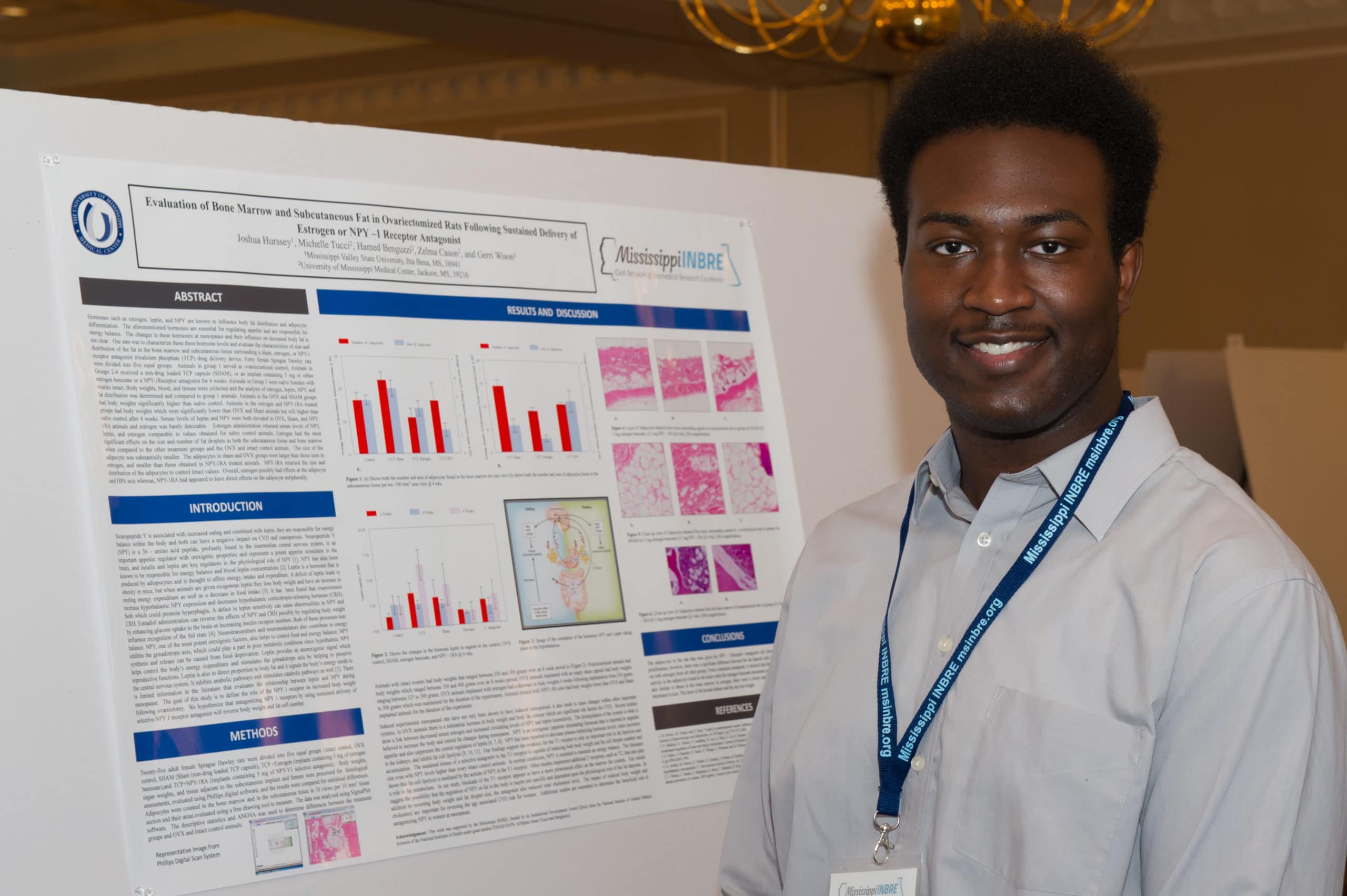 Mississippi INBRE Research Scholar, Joshua Hurssey has an MD/PhD in his Sights